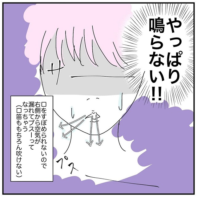 やっぱり鳴らない…！私の顔の事情を知らない先輩はめっちゃ戸惑ってしまい…？【ある日突然、顔半分が動かなくなった話】＜vol.15＞