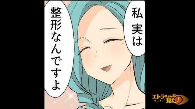 「私、整形なんです」義弟嫁の外見を褒める義両親。すると義弟嫁は“衝撃的なカミングアウト”を…→「原形とどめてない」【見た目で嫁を贔屓する姑＃4】