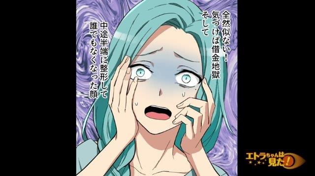 女優の顔になるため“整形地獄”に陥った女性→「どうしてそこまで…？」俺が疑問をぶつけると…【美女が整形を繰り返す理由＃6】