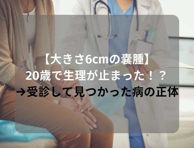 【大きさ6cmの嚢腫】20歳で生理が止まった！？→受診して見つかった“病の正体”とは