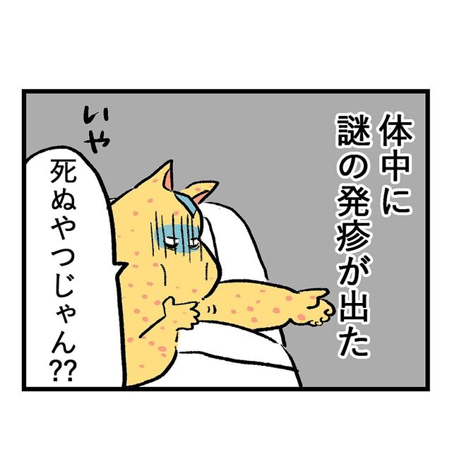 「最期が近づく？」激しい吐き気と発熱から3日後、体中に謎の『発疹』が…【重症妊娠悪阻の話＃30】