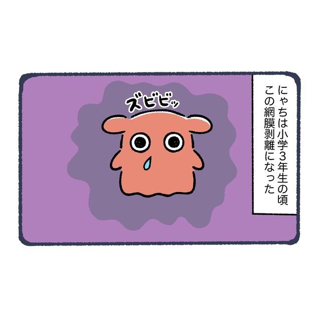 小学3年生で『網膜剥離』が発覚。即入院した私に待ち受ける“地獄”とは…【網膜剥離になってコンタクトをする話＃1】