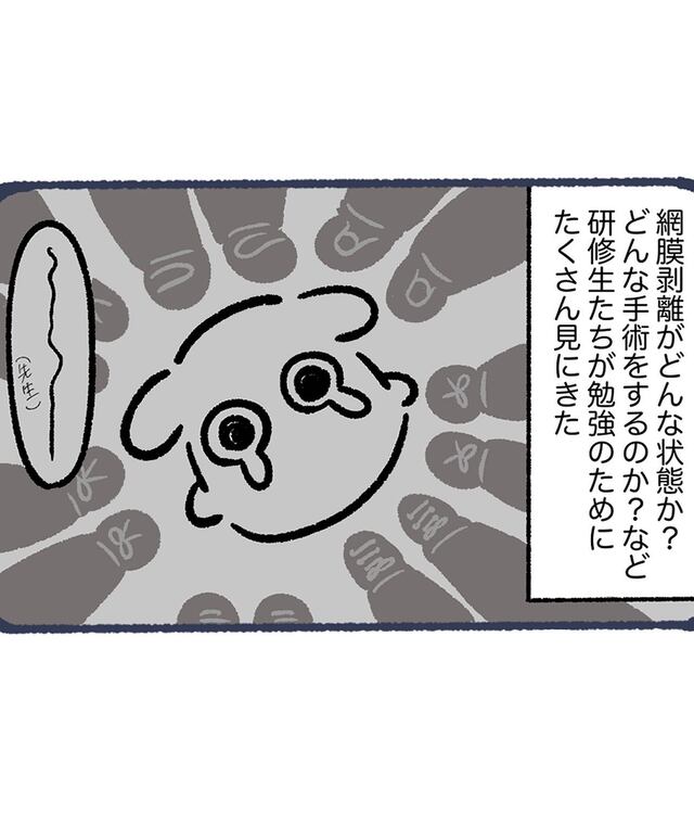 “網膜剥離”の原因は『強度の近視』。症例勉強のため多くの研修医に囲まれて恐怖し…【網膜剥離になってコンタクトをする話＃3】