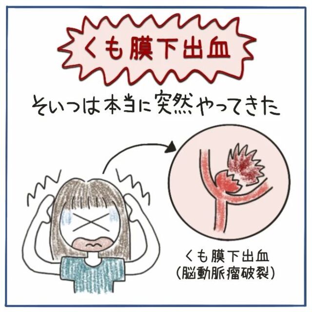 18年前、突然“くも膜下出血”を発症。激しい頭痛と吐き気を引き起こし…【‟ただの頭痛”だと思いきや、くも膜下出血＃1】