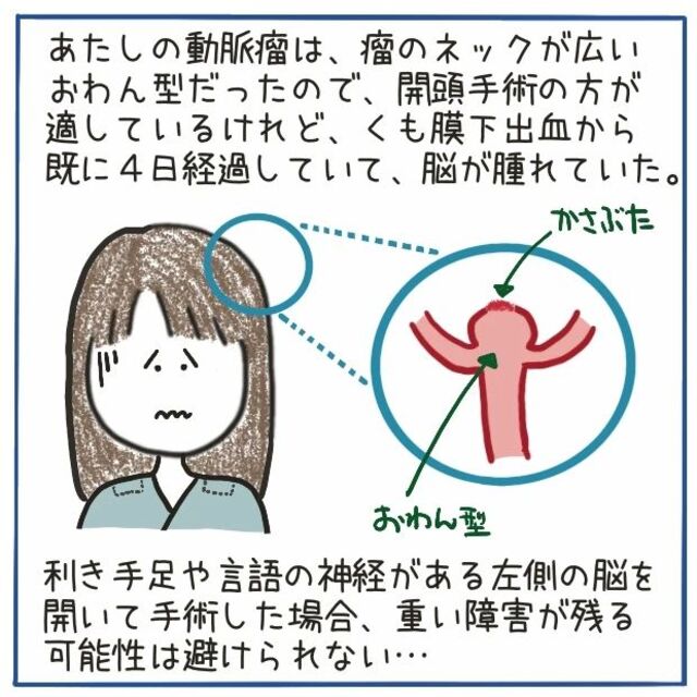 “くも膜下出血”発症から既に4日経過していた私は『血管内手術』になり…【‟ただの頭痛”だと思いきや、くも膜下出血＃25】