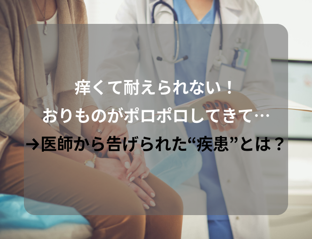 【痒くて耐えられない！】おりものがポロポロしてきて…→医師から告げられた“疾患”とは？