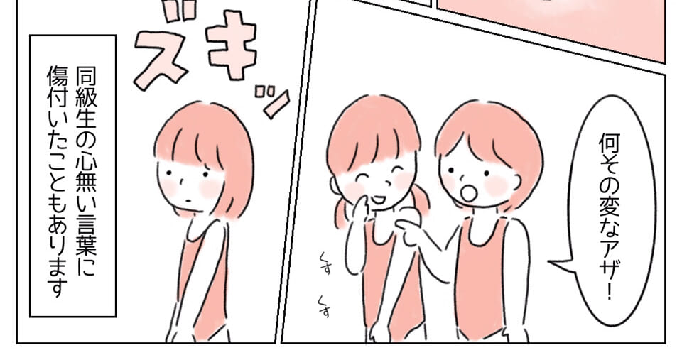 『変なアザ！』コンプレックスに対する同級生の”心無い言葉”を言われたけど…⇒読者「ハッとさせられた」「言葉ってずっと心に残る」