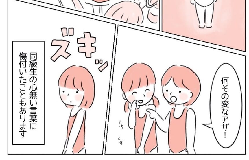 【漫画】『どうか消えて…！』コンプレックスの“アザ”に読者⇒「それだけ悩んだ証拠」「話せる場所がほしい」
