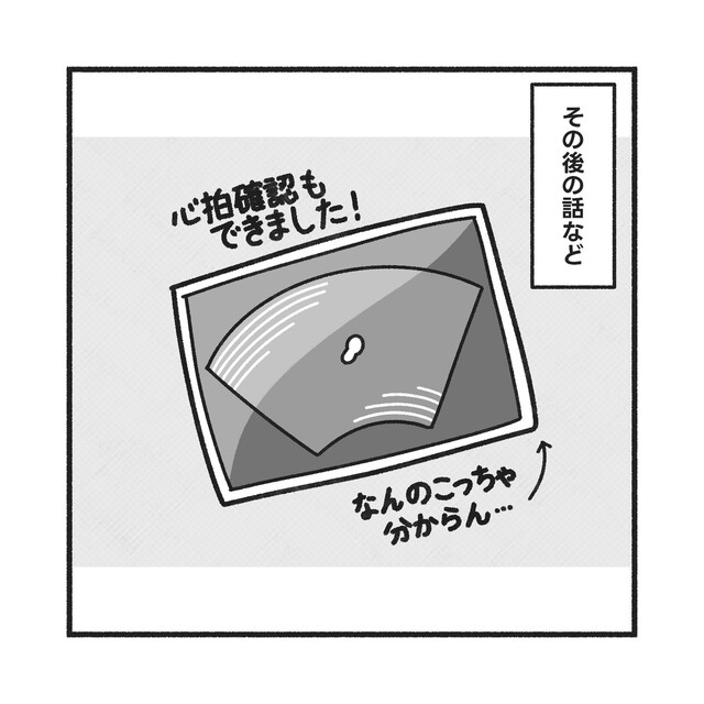 『サプリが合っていた』PCOSを乗り越え自然妊娠。“赤ちゃんの心拍”も確認でき…【PCOSだった私が自然妊娠＃最終話】