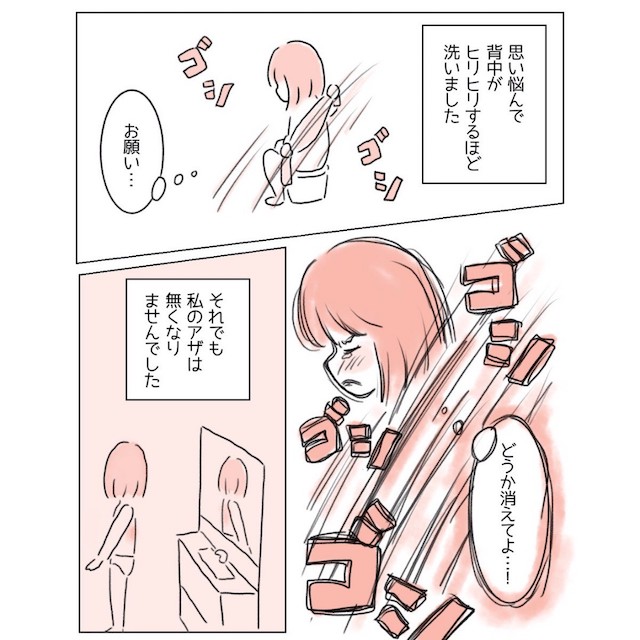 『どうか消えてよ…！』生まれつきの“背中のアザ”が嫌い！→コンプレックスを乗り越えるため【大胆な行動】に出た